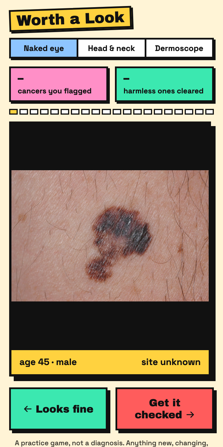 Worth a Look showing a photo of a skin spot with the patient's age and body site, and two buttons: Looks fine and Get it checked.